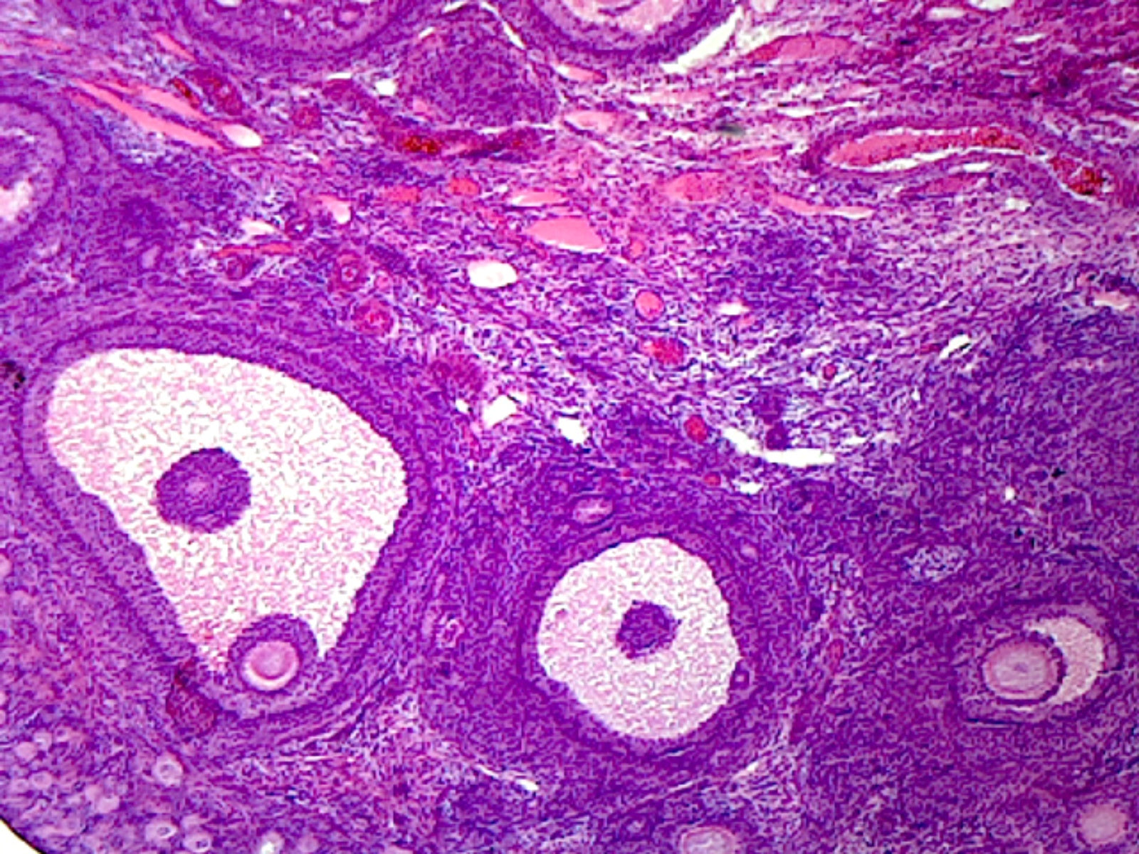 Microscope Slide, Ovary Mature, M-stain, Mammal showing general structure