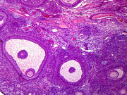 Microscope Slide, Ovary Mature, M-stain, Mammal showing general structure
