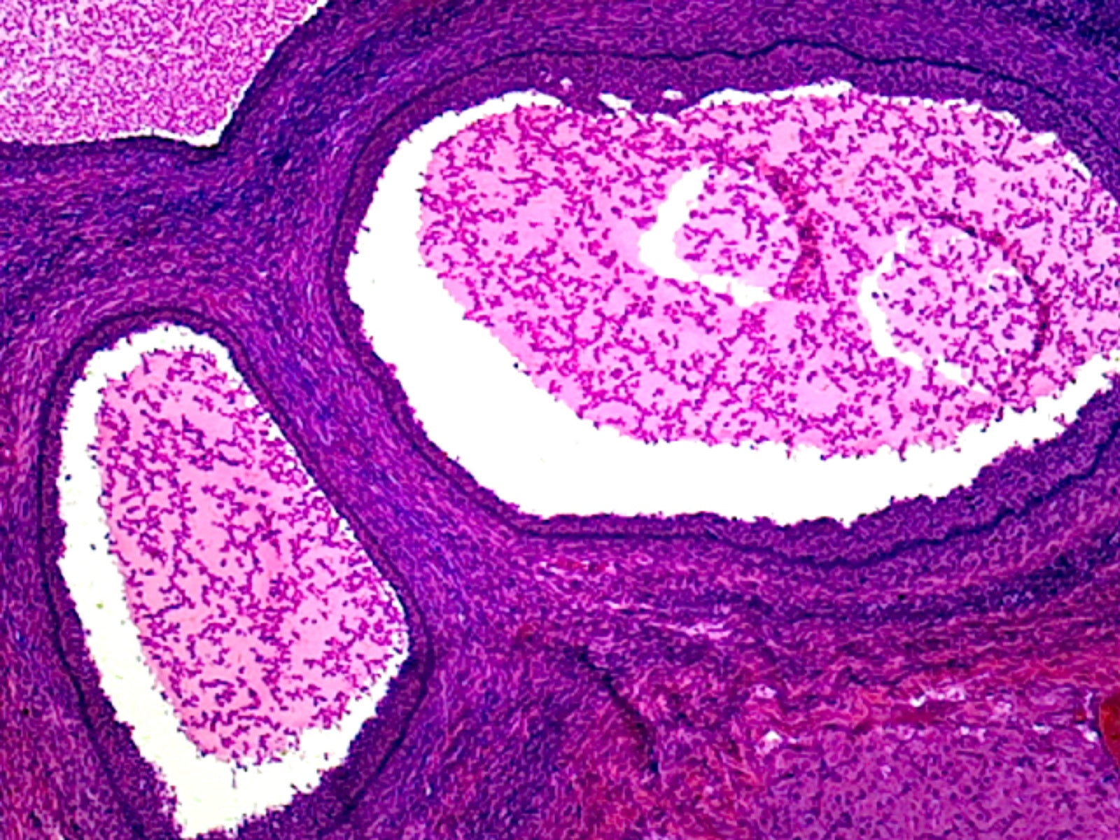 Microscope Slide, Uterus Follicular Phase, Section, Human, Showing Early or Late Phase