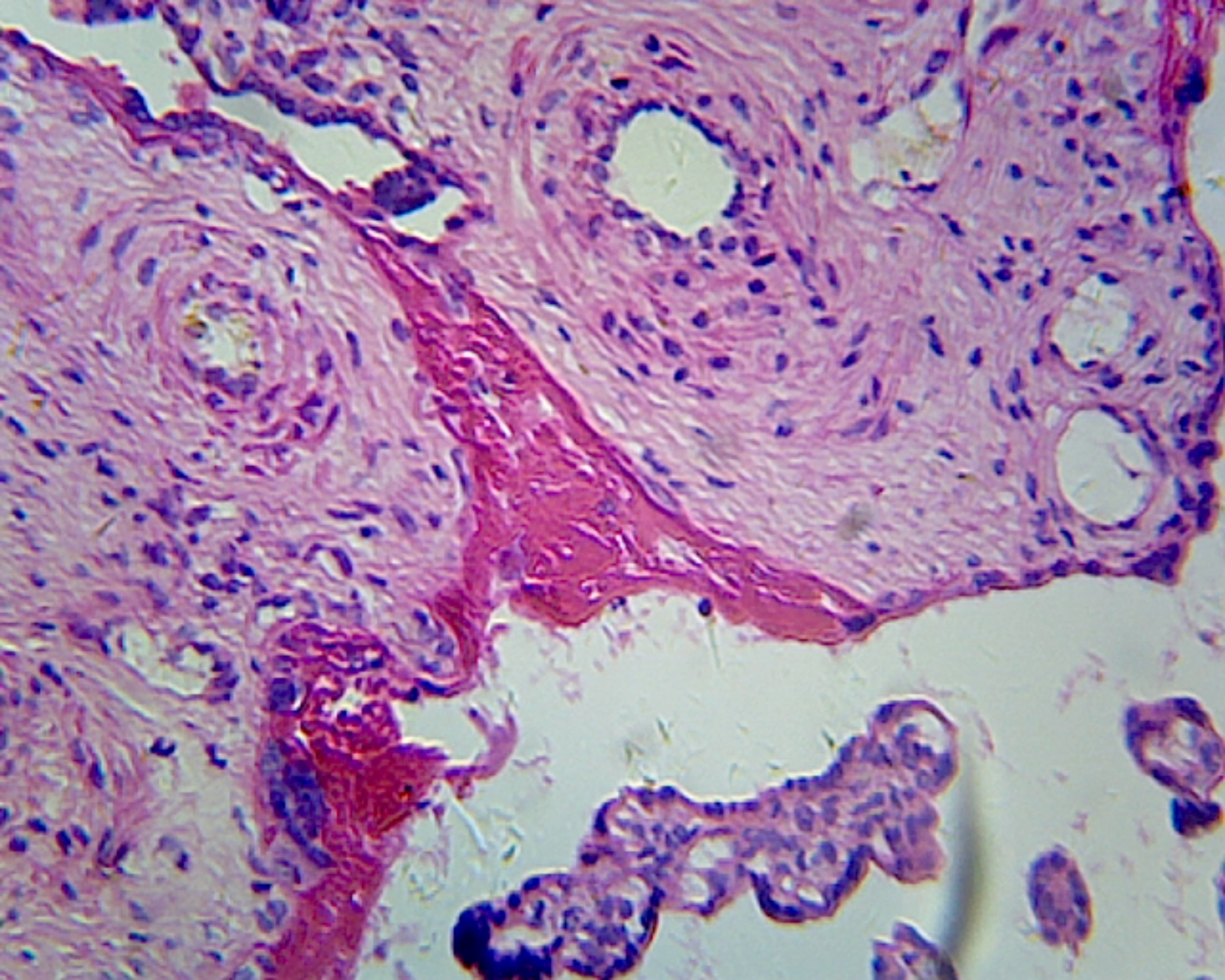 Microscope Slide, Placenta, Section, Human, showing Chorionic Villi
