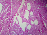 Microscope Slide, Lung, Sec. Human, showing Alveoli