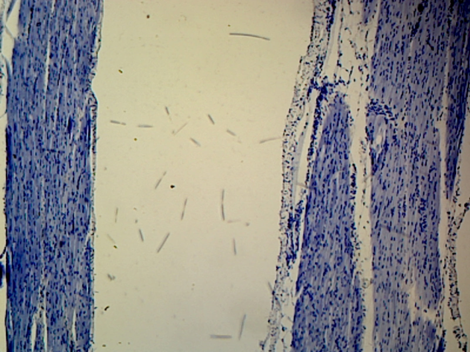 Microscope Slide, Skeletal Muscle L.S. Mammal