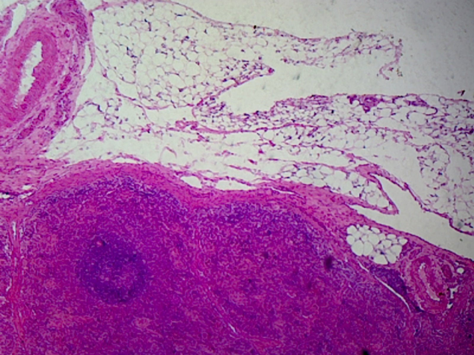 Microscope Slide, Spleen, Section, H&E Stain, Mammalian