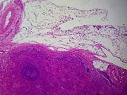 Microscope Slide, Spleen, Section, H&E Stain, Mammalian