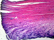 Microscope Slide, White Fibrocartilage, Mammal Section from Intervertebral Disc