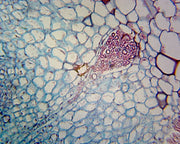 Microscope Slide, Marchantia Gemmae W.M.