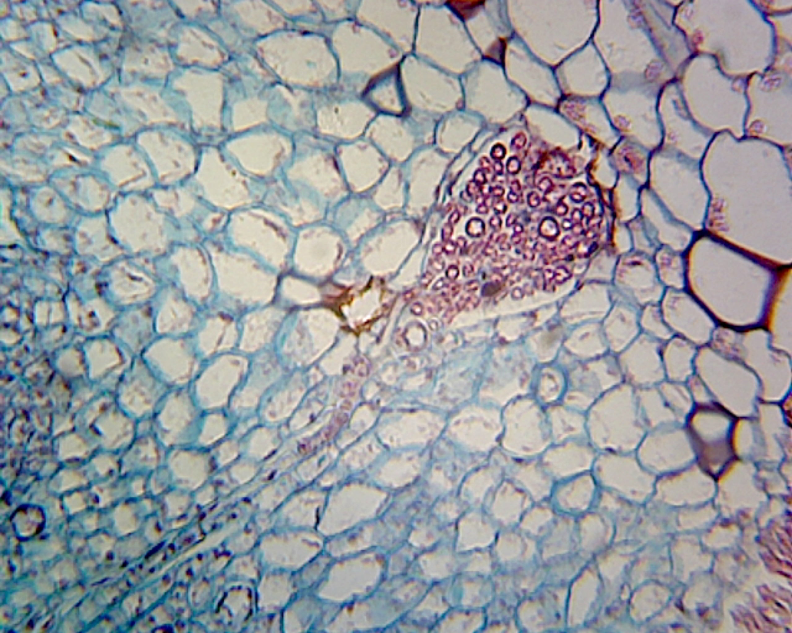 Microscope Slide, Marchantia Gemmae W.M.