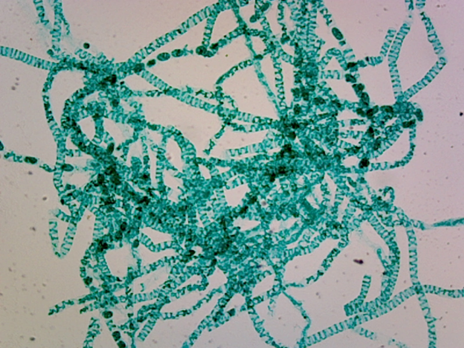 Microscope Slide, Spirogyra Scalari Form Conjugation; W.M. Showing Zygote