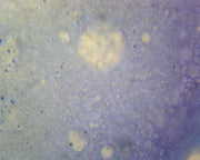 Microscope Slide, Mycobacterium Tuberculosis, smear, Gram pos., etiologic agent of tuberculosis in humans
