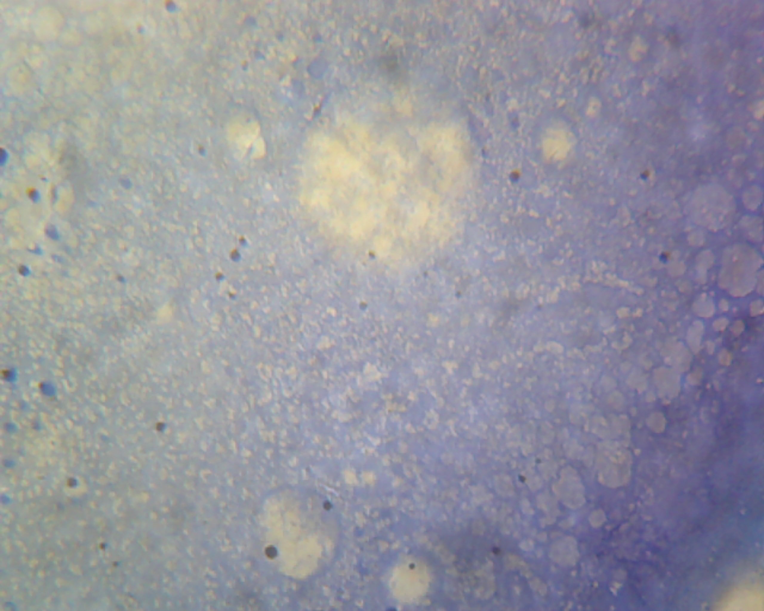 Microscope Slide, Mycobacterium Tuberculosis, smear, Gram pos., etiologic agent of tuberculosis in humans