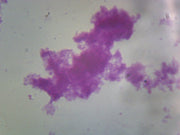 Microscope Slide, Neisseria Gonorrhea smear Gram-, aerobic bacteria