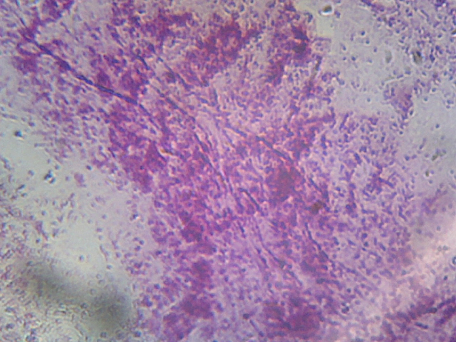 Microscope Slide, Pseudomonas Aeruginosa, smear, Gram-, rod-shaped, causes variety of systemic infections