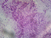 Microscope Slide, Pseudomonas Aeruginosa, smear, Gram-, rod-shaped, causes variety of systemic infections