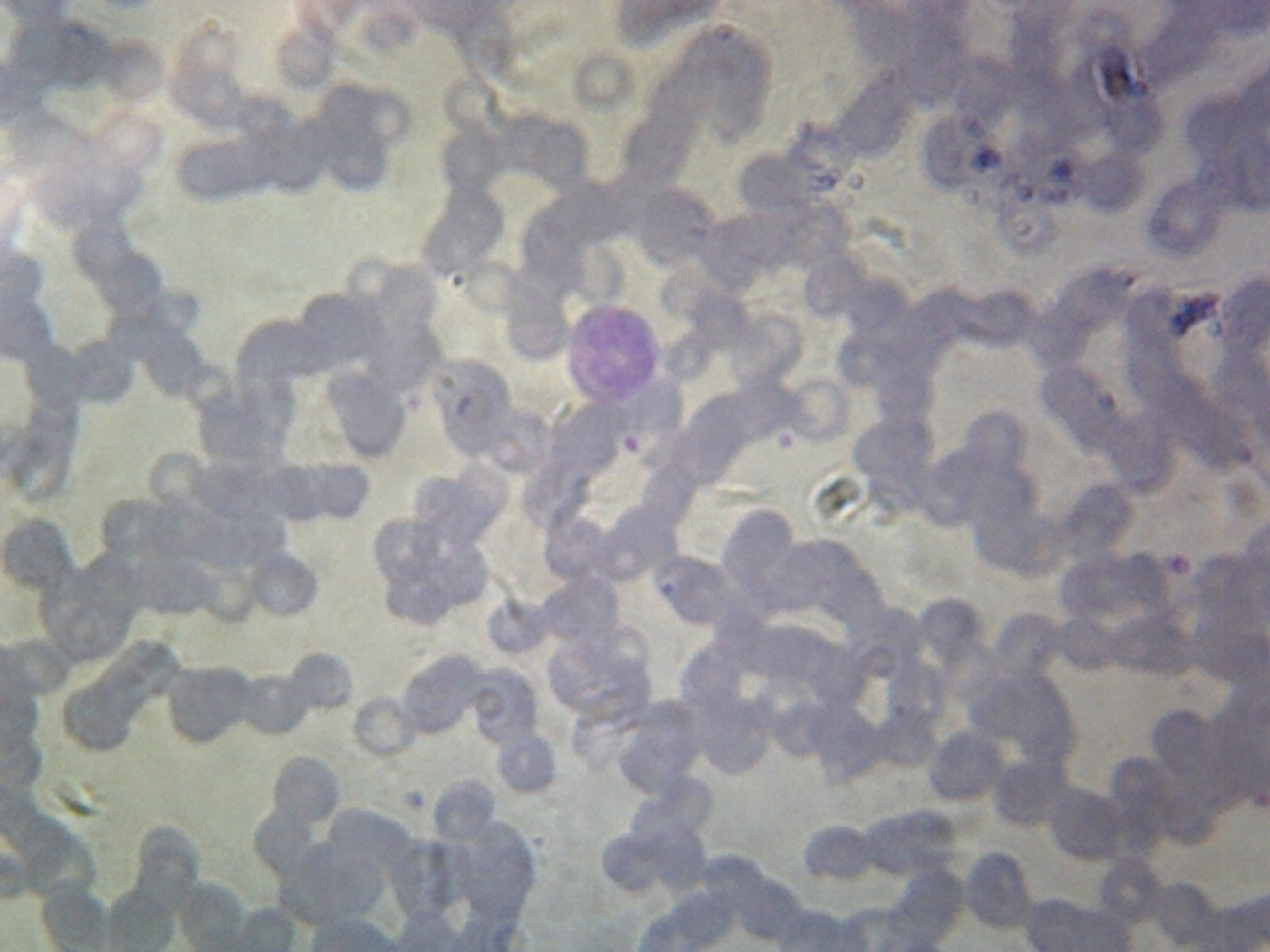 Microscope Slide, Balantidium Coli Trophozoites, Smear, Spirotrich, pathogenic ciliate, infects digestive tract