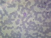 Microscope Slide, Balantidium Coli Trophozoites, Smear, Spirotrich, pathogenic ciliate, infects digestive tract