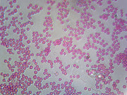 Microscope Slide, Meningococcus, smear Neisseria meningitidis, Gram