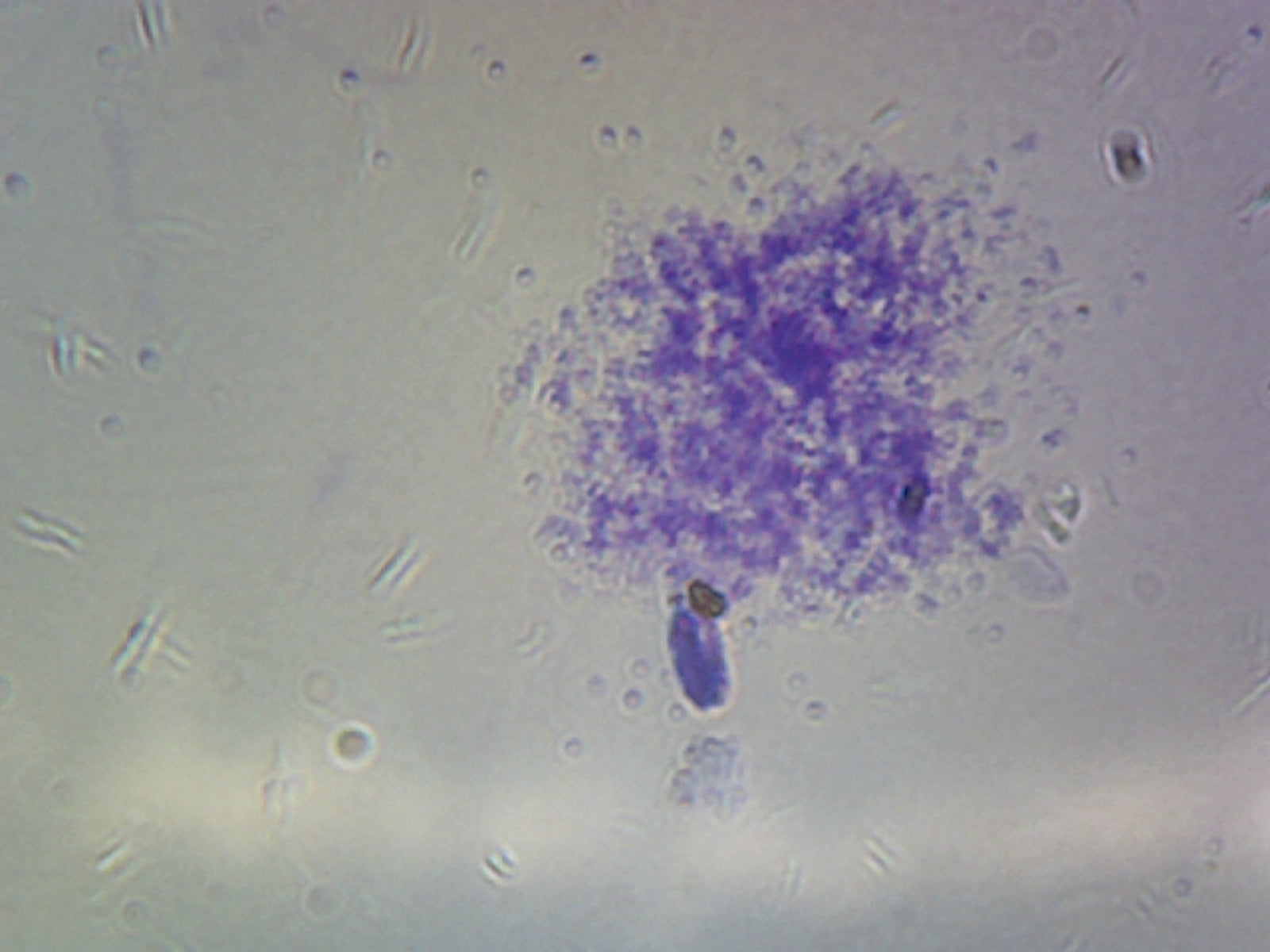 Microscope Slide, Staphylococcus Aureus, smear, Gram positive