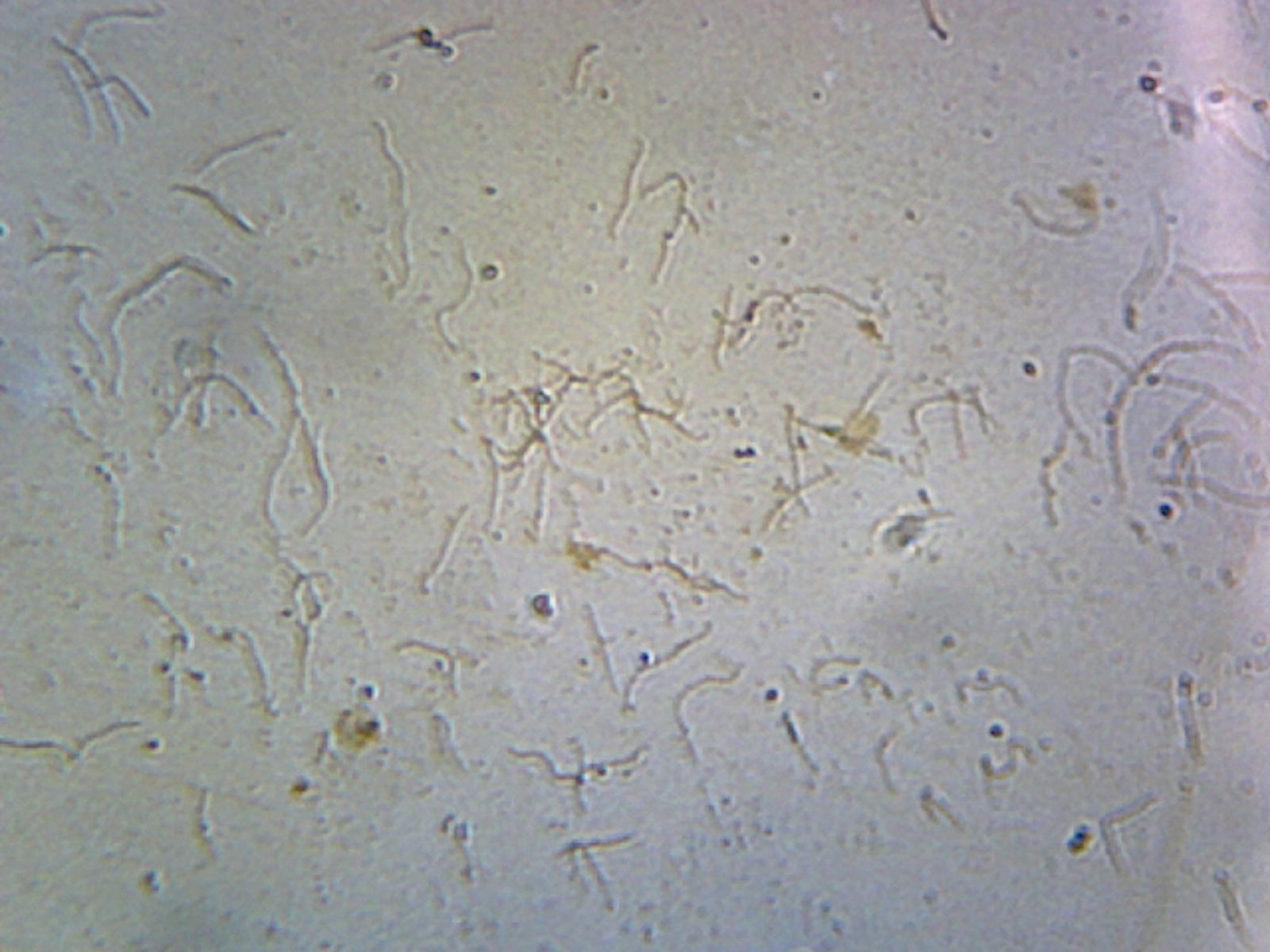 Microscope Slide, Leptospira, smear; Agent of Leptospirosis disease