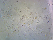 Microscope Slide, Leptospira, smear; Agent of Leptospirosis disease