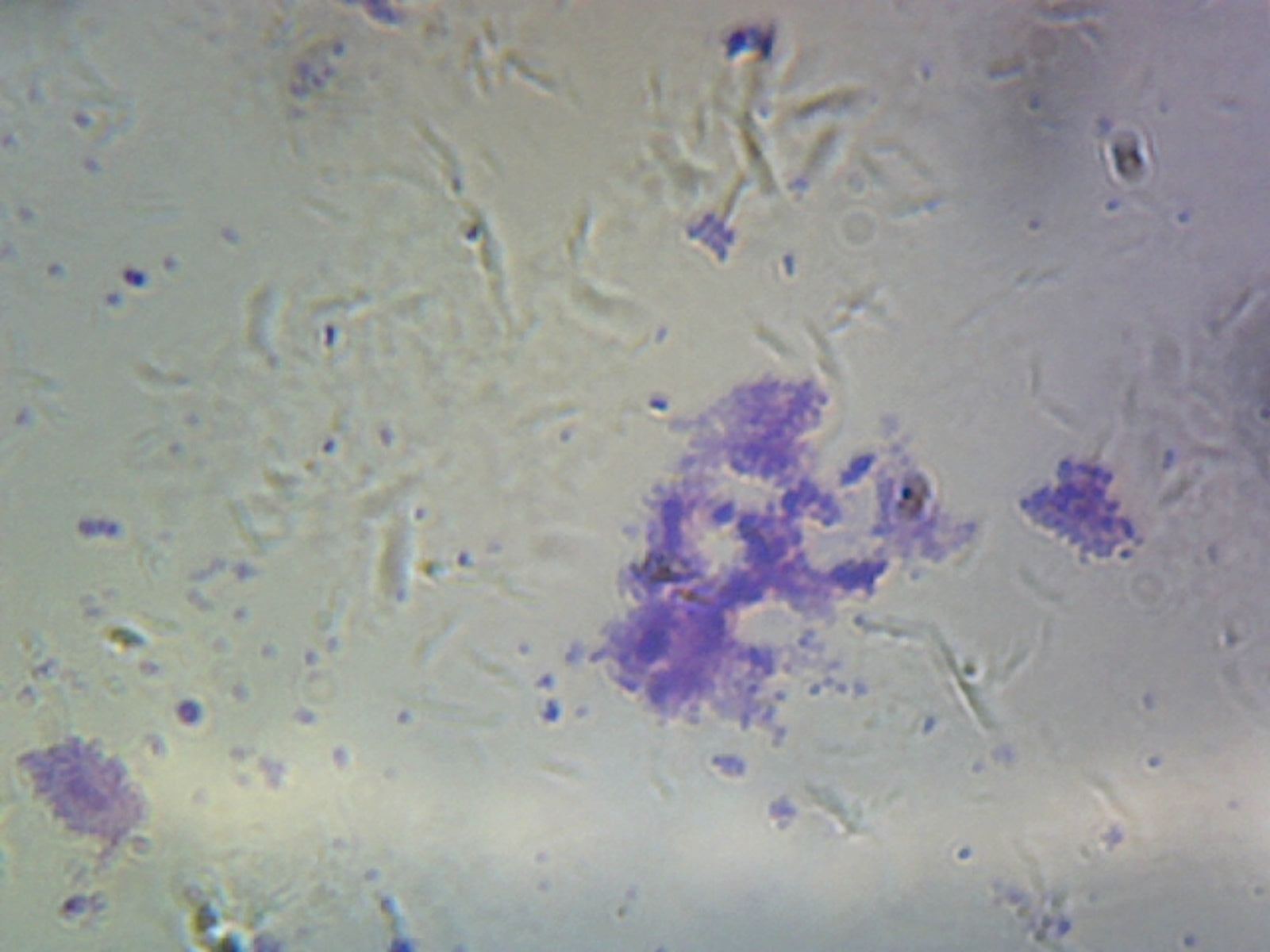 Microscope Slide, Streptococcus (Diplococcus) pneumonia, smear, Gram Positive