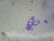 Microscope Slide, Streptococcus (Diplococcus) pneumonia, smear, Gram Positive