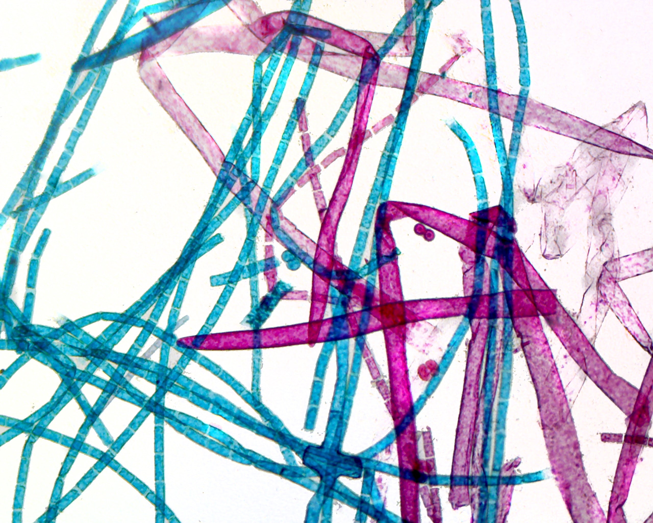 Microscope Slide, Protista, Cladophore, Whole mount, showing branching filamentous algae