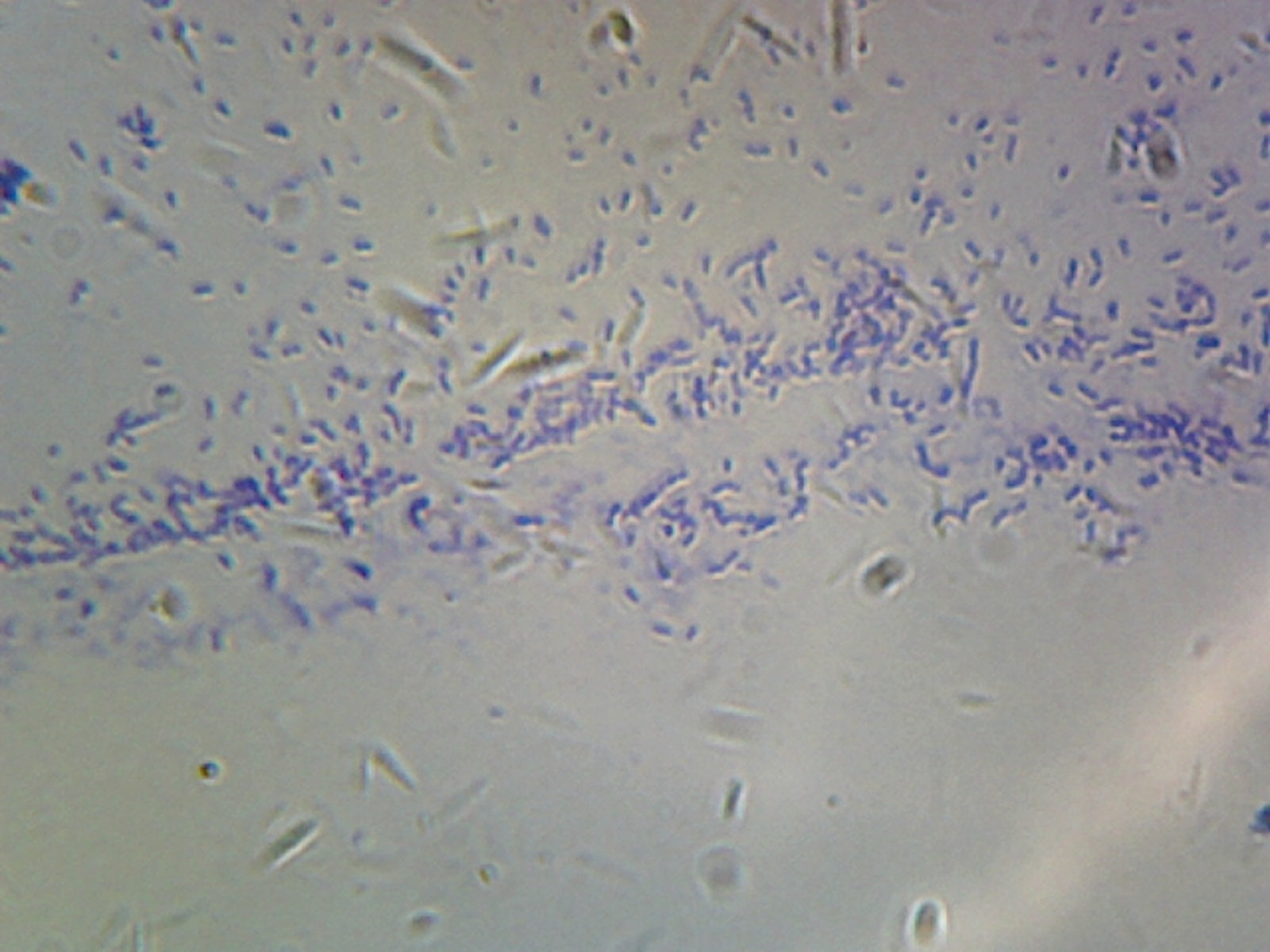Microscope Slide, Bacillus, Smear Gram Positive and Gram Negative Mixed