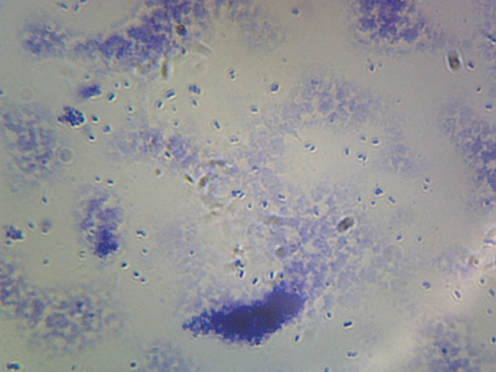 Microscope Slide, Clostridium Perfringens, Smear Gram Positive