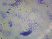 Microscope Slide, Clostridium Perfringens, Smear Gram Positive