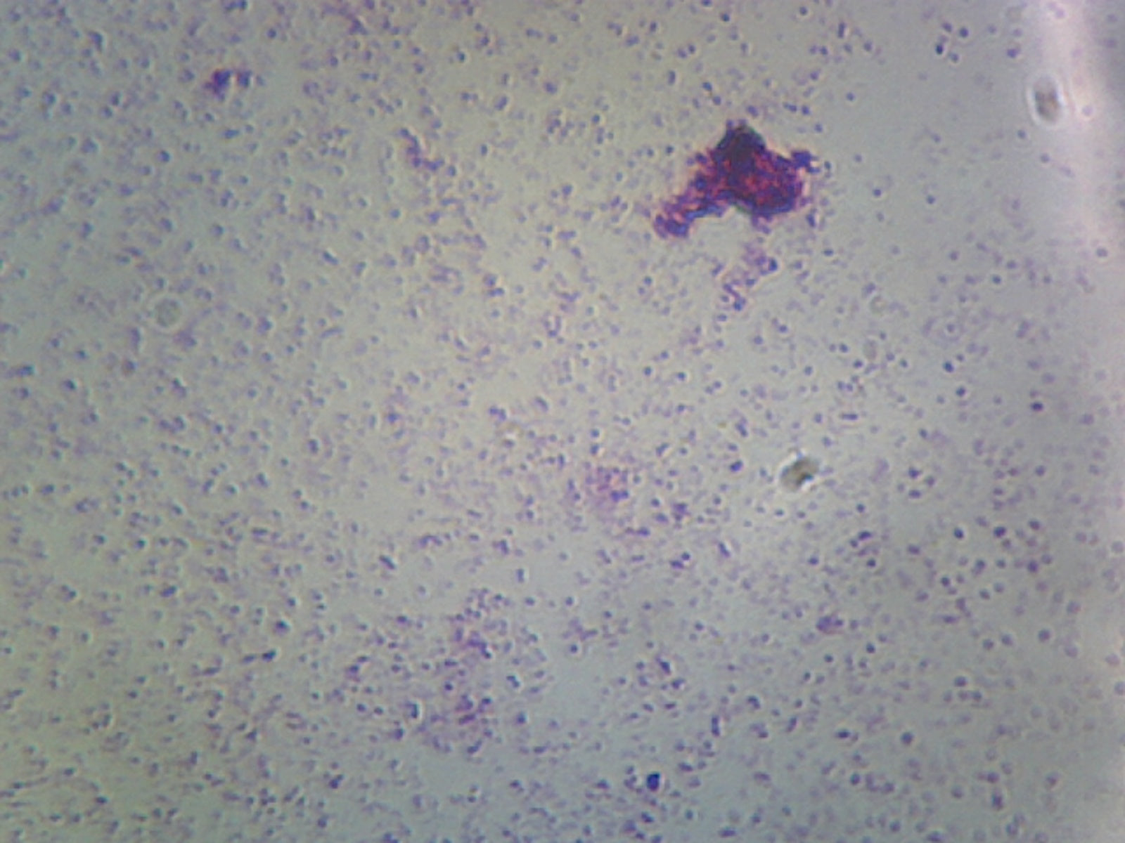 Microscope Slide, Nitrogen Fixing Bacteria; Azotobacter and Rhizobium Leguminosarum; Smear; Gram Negative