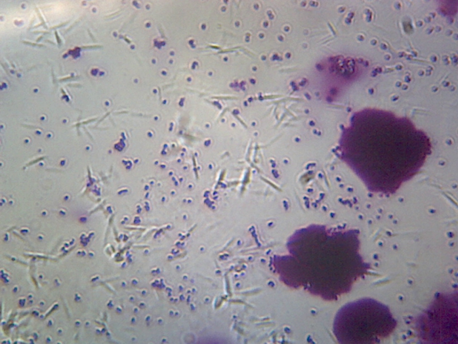 Microscope Slide, Bacteria from Human Mouth, Smear Showing Different Types of Bacteria