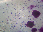 Microscope Slide, Bacteria from Human Mouth, Smear Showing Different Types of Bacteria