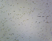 Microscope Slide, Clostridium Botulinum, smear, Gram pos., Spore-forming anaerobic rods, Agent of botulinum