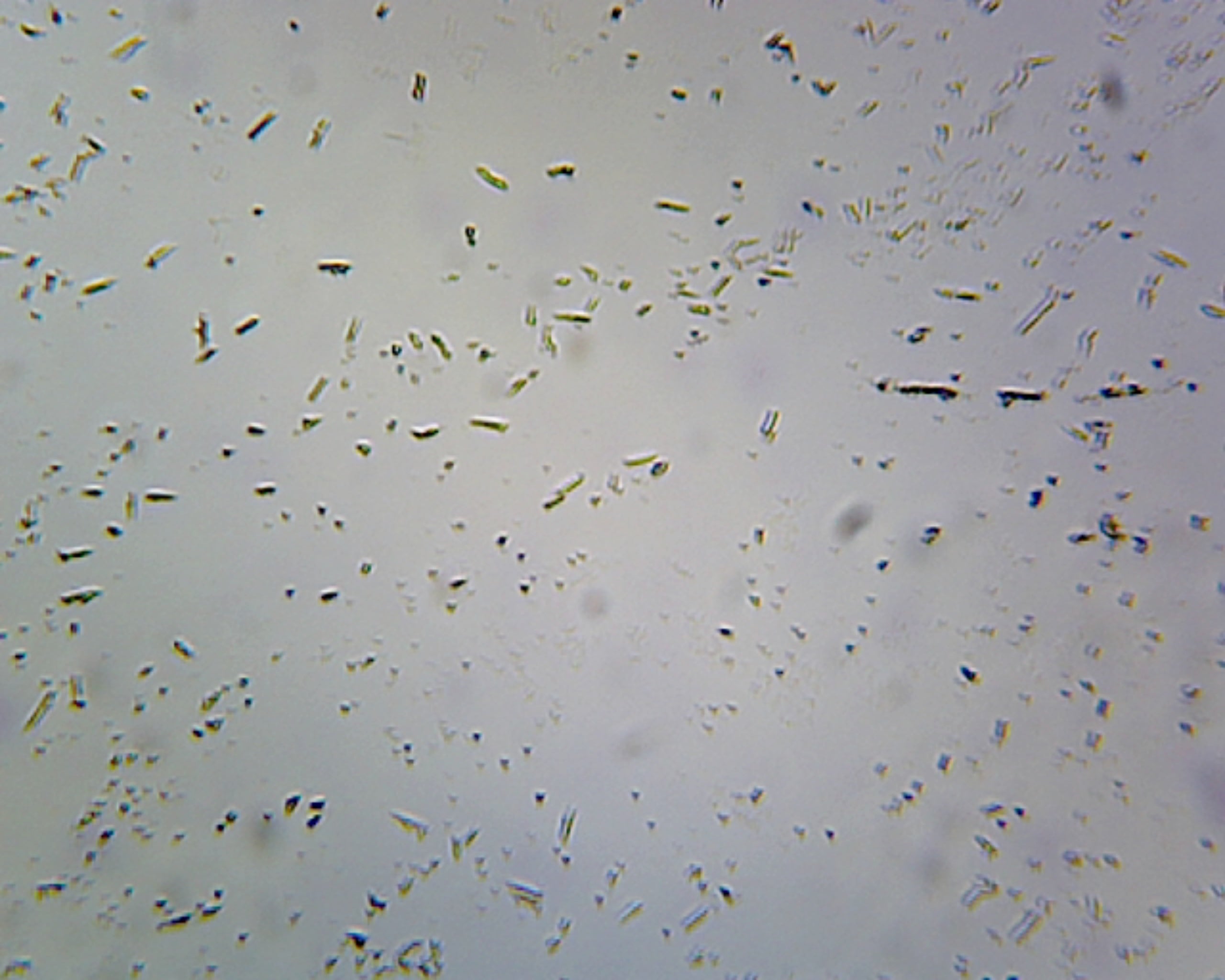 Microscope Slide, Clostridium Botulinum, smear, Gram pos., Spore-forming anaerobic rods, Agent of botulinum