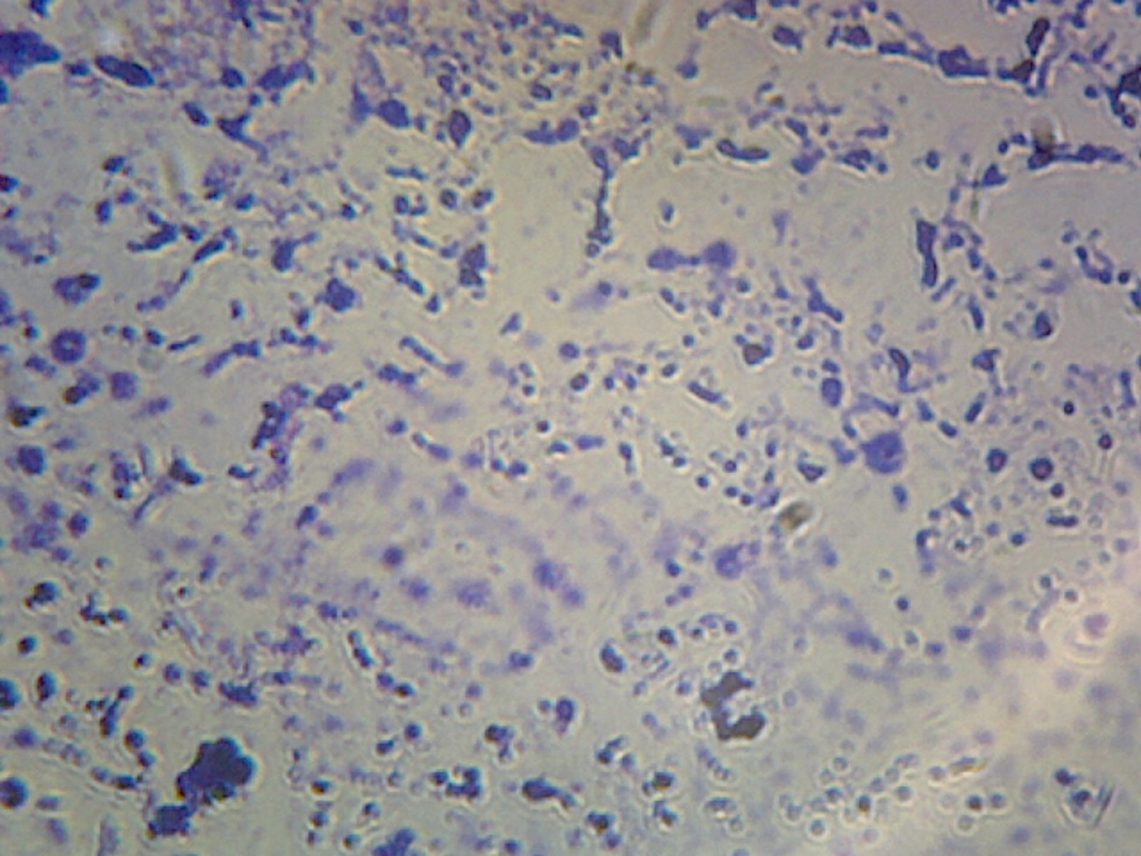 Microscope Slide, Clostridium Tetani, smear; Gram pos., Spore-forming anaerobic rods, Agent of tetanus in humans
