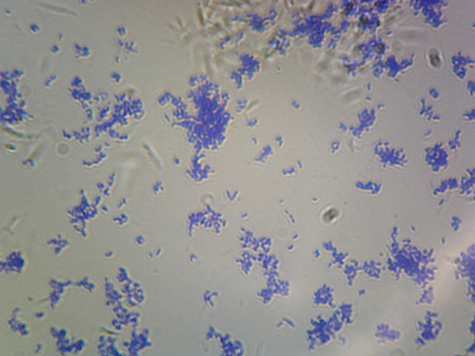 Microscope Slide, Corynebacterium Diphtheriae, smear, Gram pos., rod-shaped, agent of diphtheria