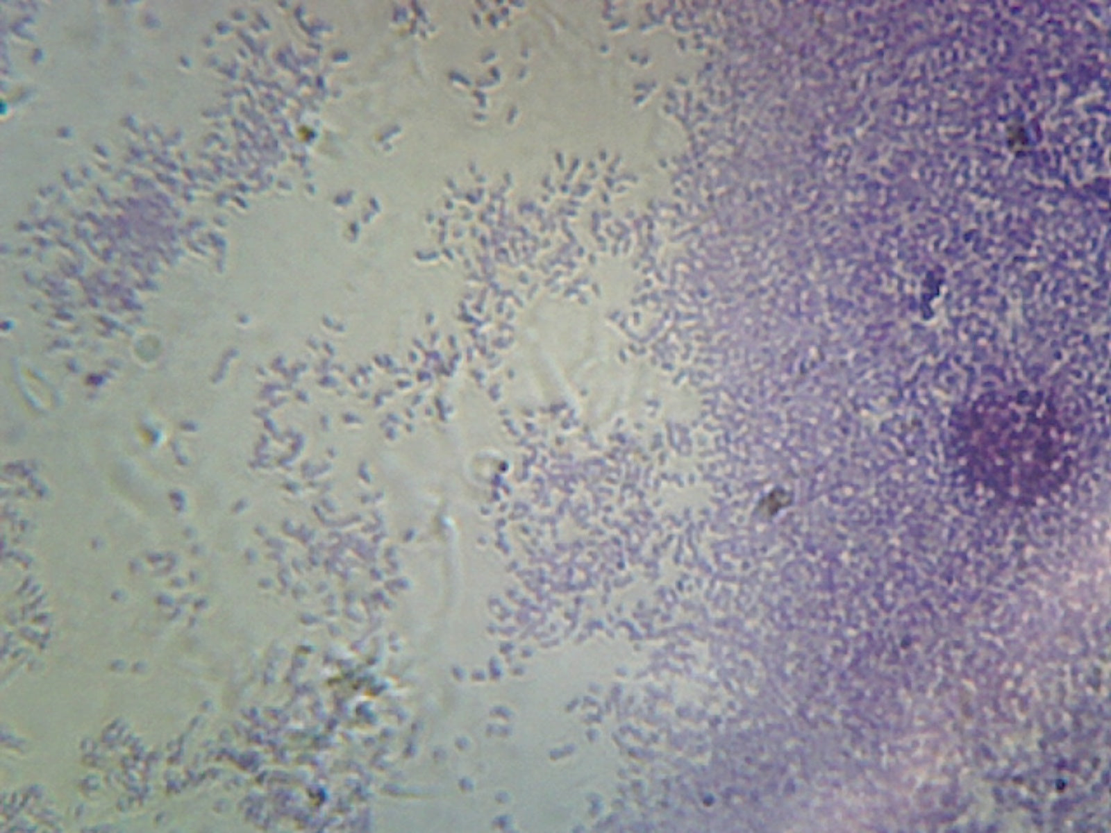 Microscope Slide, Proteus Vulgaris, smear Gram-, agent of urinary tract infections