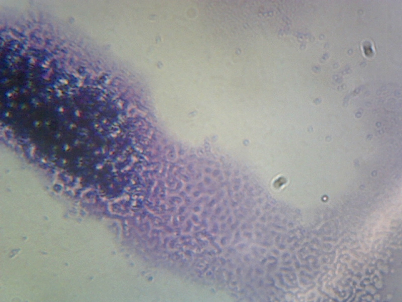 Microscope Slide, Shigella Dysenteriae, smear, human pathogen, Gram- rod, from family Enterobacteriaceae