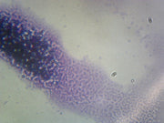 Microscope Slide, Shigella Dysenteriae, smear, human pathogen, Gram- rod, from family Enterobacteriaceae