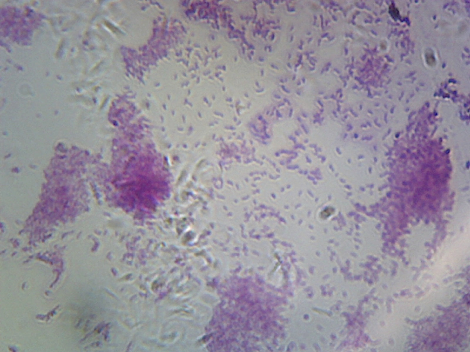 Microscope Slide, Vibrio Cholerae smear