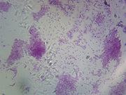 Microscope Slide, Vibrio Cholerae smear