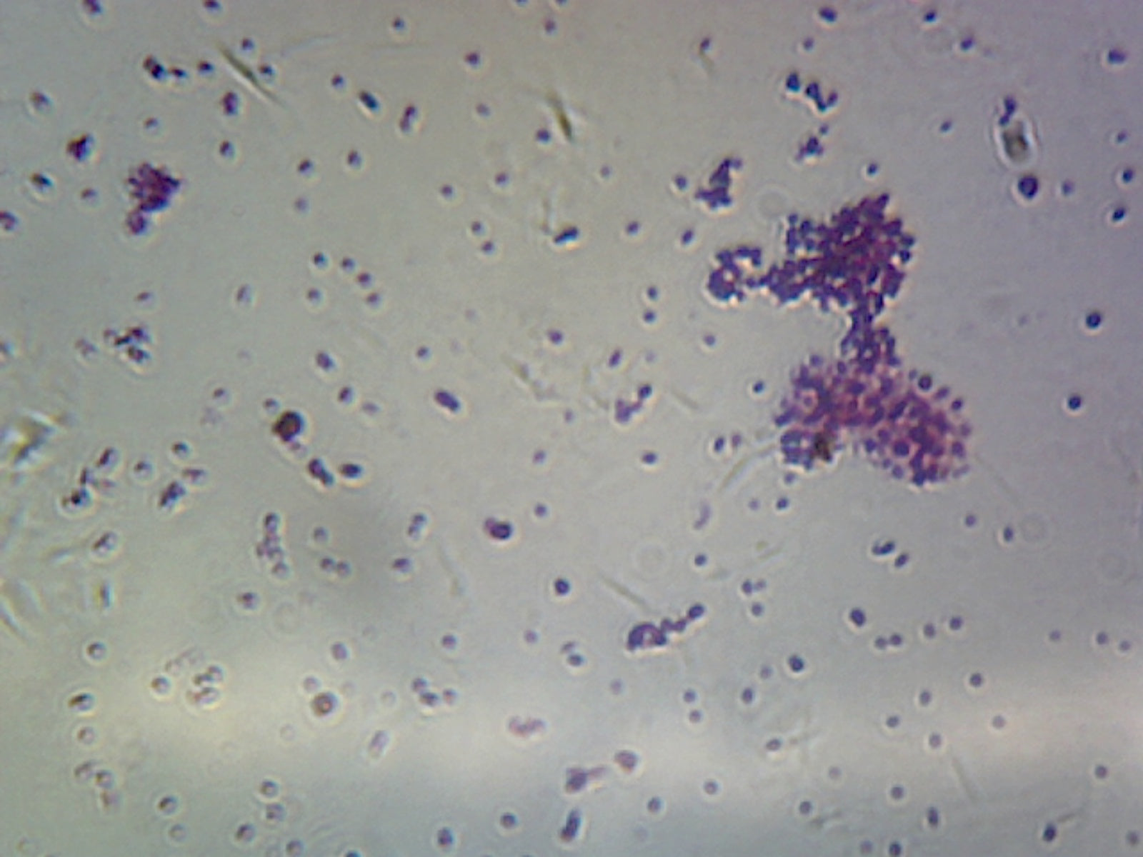 Microscope Slide, Cocci, Smear, Diplococci Neisseria Gram - and Enterococcus Gram +