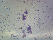 Microscope Slide, Coccus, smear; Mixed Diplococci, Hemophilus Gram Negative, and Streptococcus pneumoniae Gram Positive