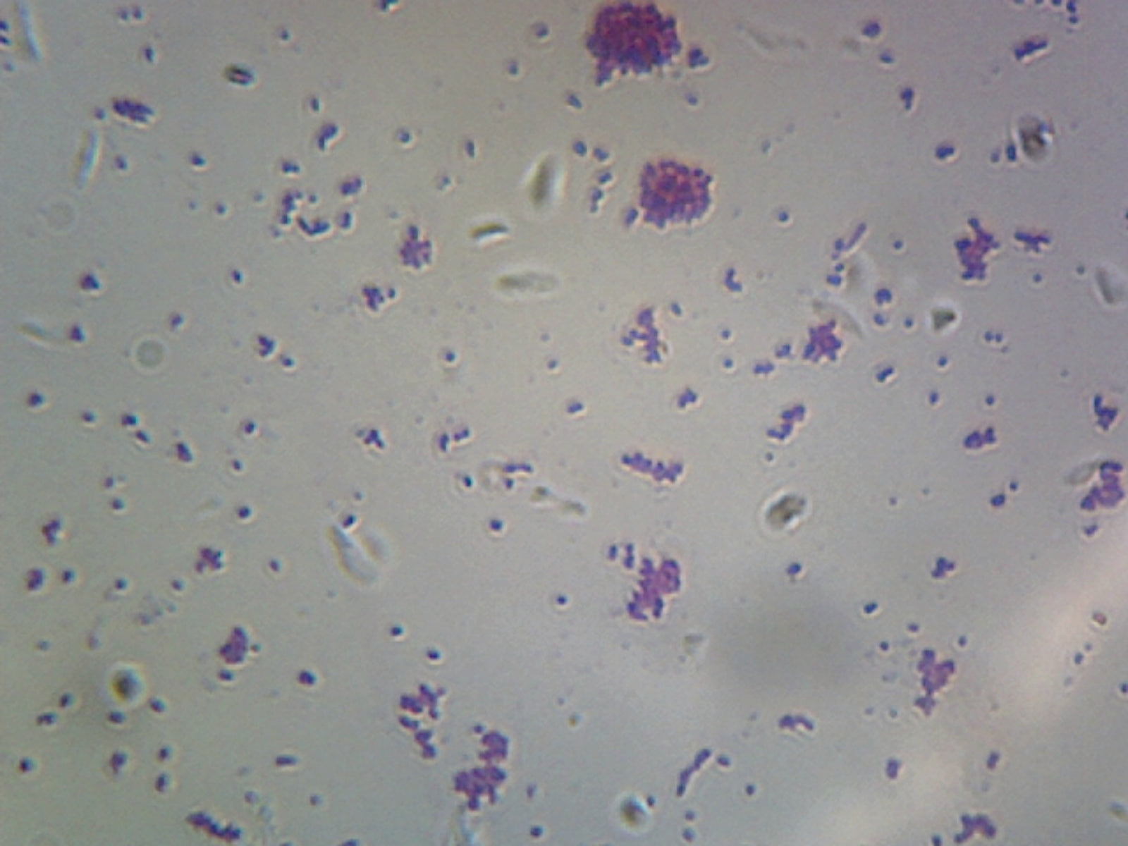 Microscope Slide, Cocci Spherical Bacteria, Coccus, Smear, Gram Negative.