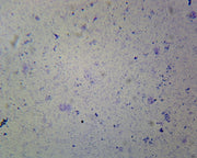 Microscope Slide, Coccus Smear, Gram Positive