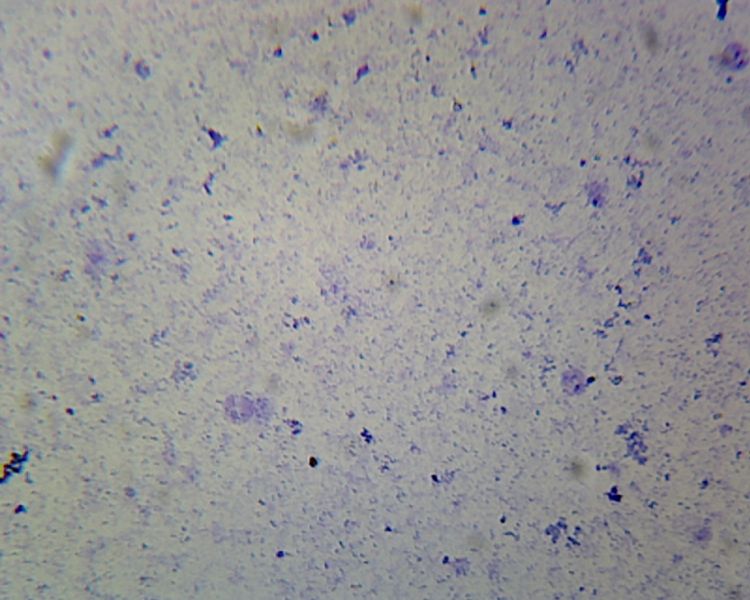 Microscope Slide, Coccus Smear, Gram Positive