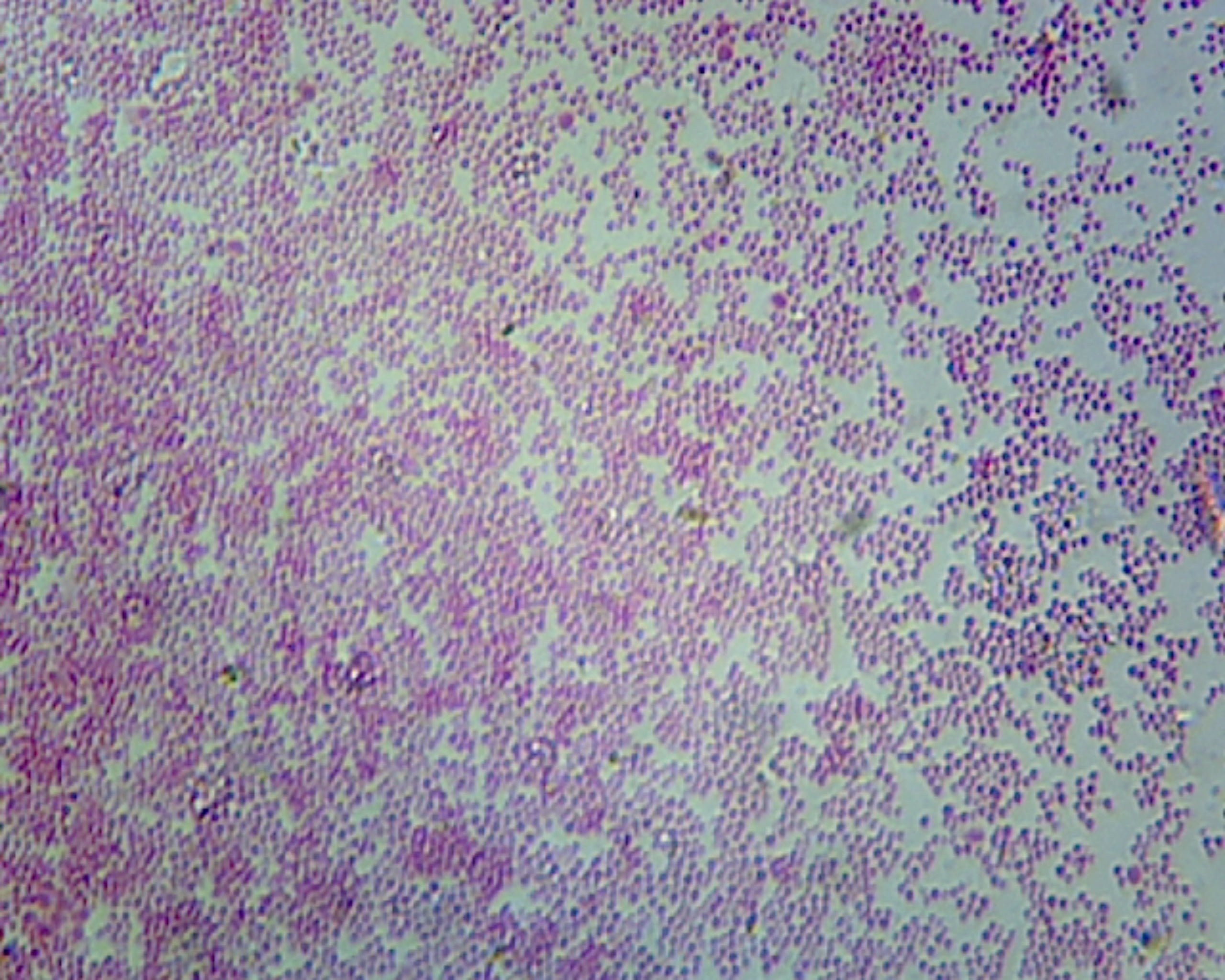 Microscope Slide, Escherichia Coli Smear Gram Negative, Rod-Shaped, Non Spore Forming Intestinal Flora