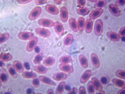Microscope Slide, Blood Smear Amphiuma