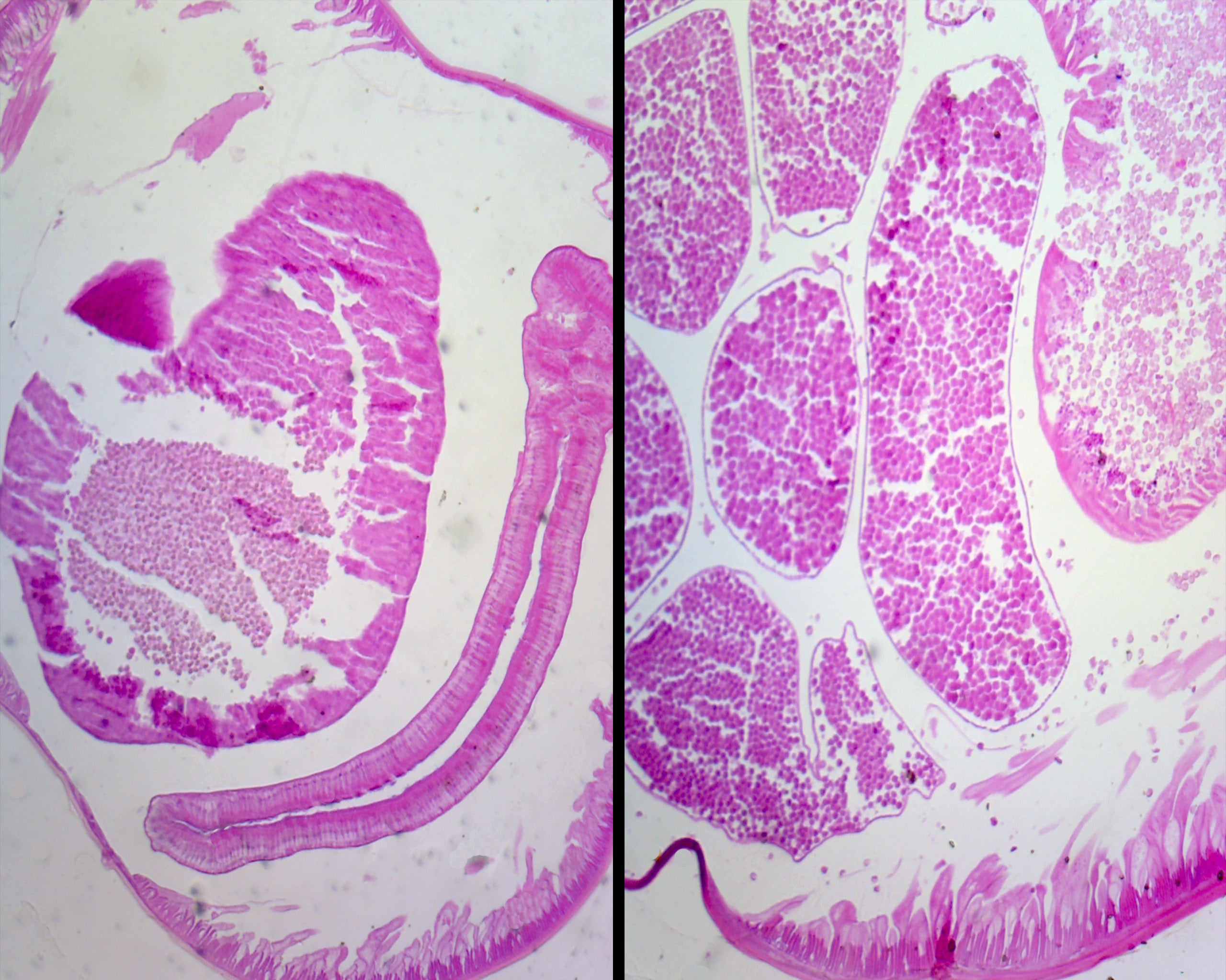 Microscope Slide, Ascaris Lumbricoides Male & Female, C.S.