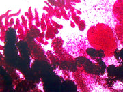 Microscope Slide, Clonorchis Sinensis W.M. , Human Liver Fluke